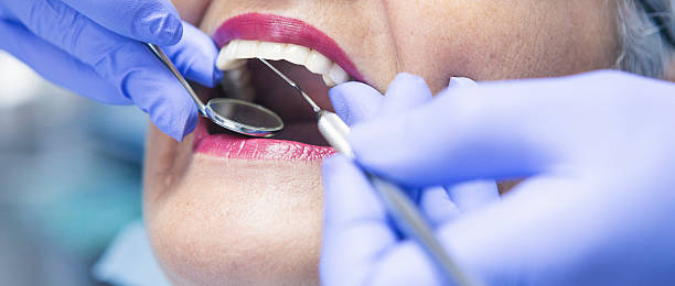 Best Emergency Dental Extractions in Merian, ID
